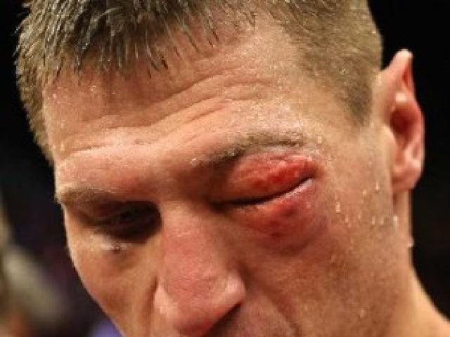 Gołota suffered Mollo&rsquo;s right